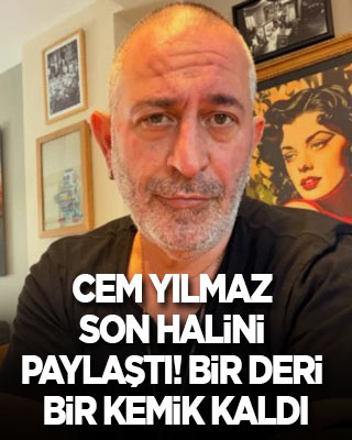 Cem Yılmaz son halini paylaştı! Bir deri bir kemik kaldı