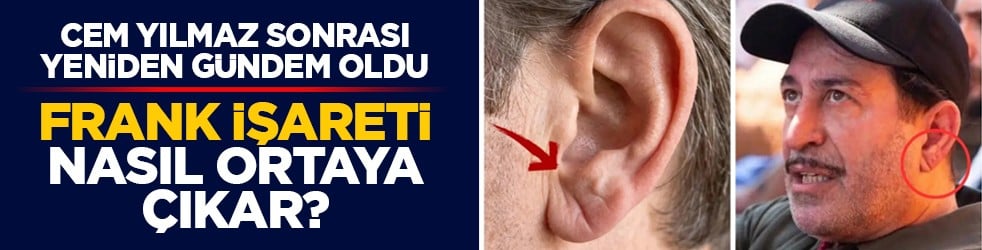 Cem Yılmaz sonrası yeniden gündem oldu: Frank işareti nasıl ortaya çıkar?