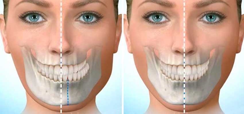 Çene ağrısı için hangi doktora gidilir?