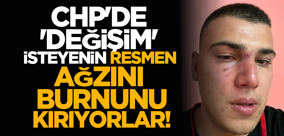 CHP'de 'değişim' isteyenin resmen ağzını burnunu kırıyorlar!