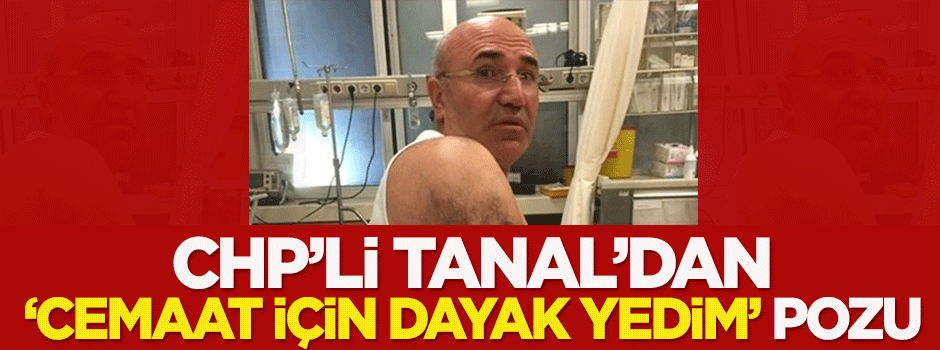 CHP'li Tanal'dan 'cemaat için dayak yedim' pozu