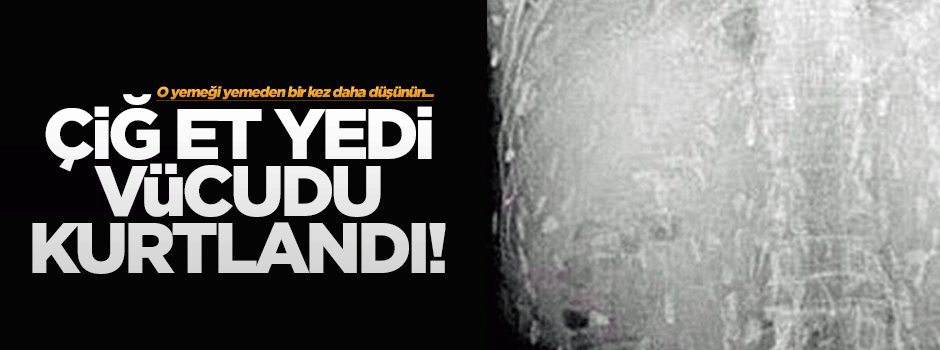 Çiğ et yedi, vücudu kurtlandı!