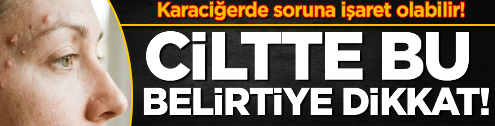 Ciltte bu belirtiye dikkat: Karaciğerde soruna işaret edebilir!