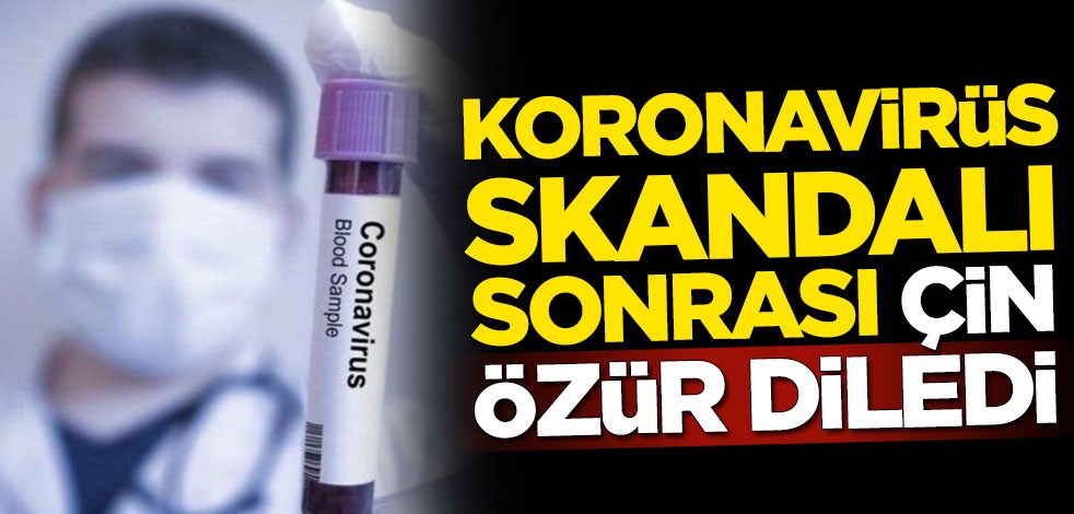Çin koronavirüs skandalı sonrası özür diledi