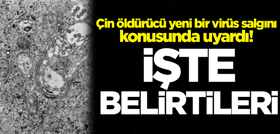 Çin öldürücü yeni bir virüs salgını konusunda uyardı! İşte belirtileri