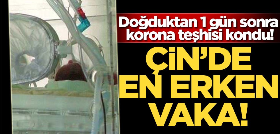 Çin'de en erken vaka! Doğduktan 1 gün sonra korona teşhisi kondu!