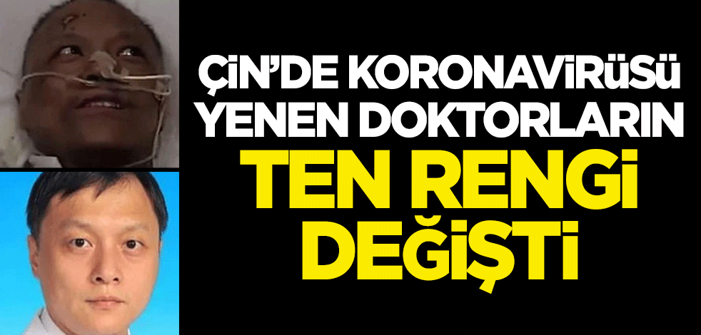 Çin’de koronavirüsü yenen doktorların ten rengi değişti