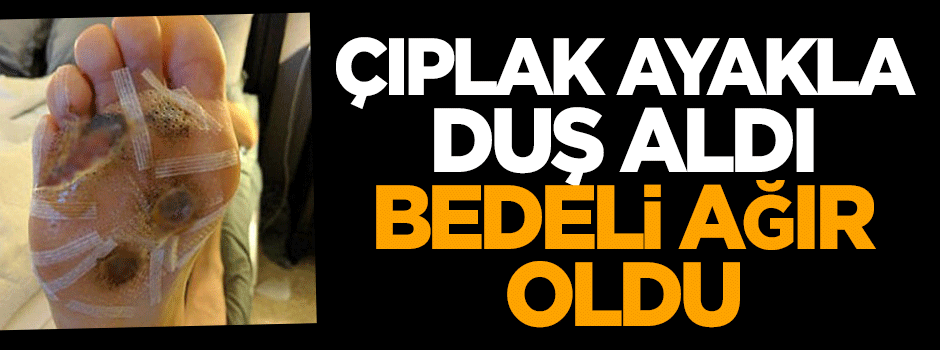 Çıplak ayakla duş aldı, bedeli ağır oldu