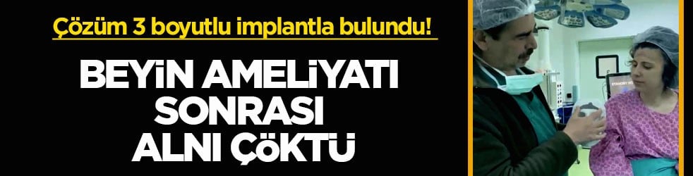 Çözüm 3 boyutlu implantla bulundu! Beyin ameliyatı sonrası alnı çöktü
