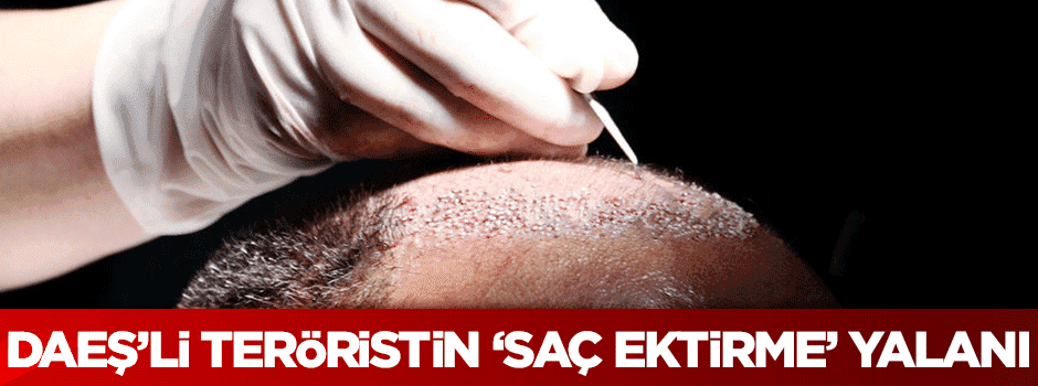 DAEŞ'li teröristin 'saç ektirme' yalanı