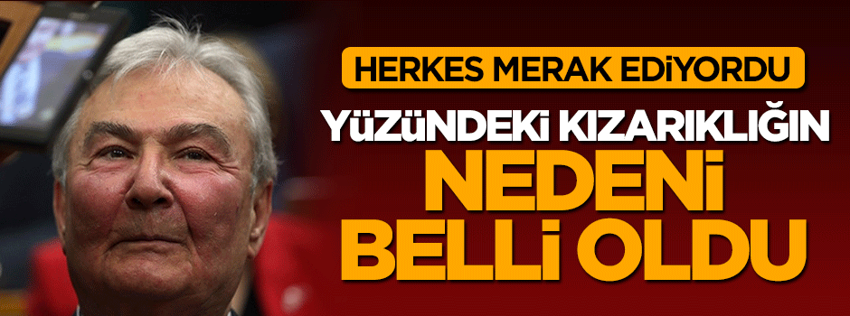 O ismin yüzündeki kızarıklığın nedeni belli oldu