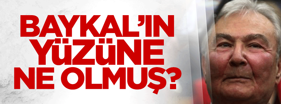 Deniz Baykal'ın yüzüne ne oldu?