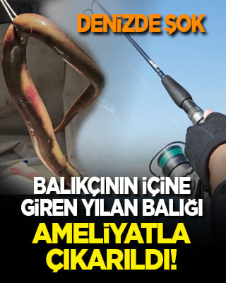 Denizde şok! Utancından kimseye söylememiş! Balıkçının içine giren yılan balığı ameliyatla çıkarıldı!