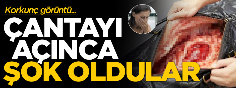 Deri çantanın içindeki organları görünce şok oldular