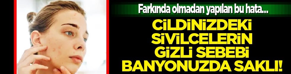 Dermatologlar tek bir seste birleşiyor: Cildinizdeki sivilcelerin gizli sebebi banyonuzda saklı!