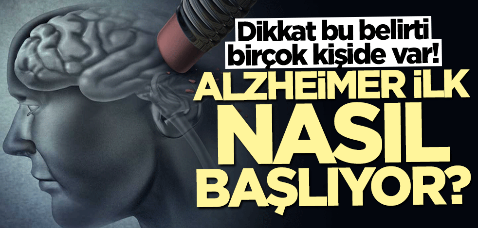Dikkat bu belirti birçok kişide var! Alzheimer ilk nasıl başlıyor?