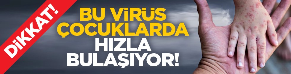 Dikkat! Bu virüs çocuklarda hızla bulaşıyor!