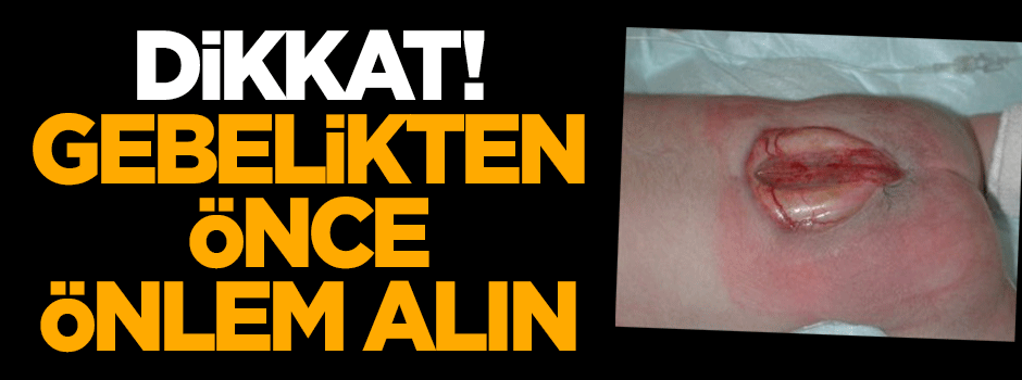 Dikkat! Gebelikten önce önlem alın