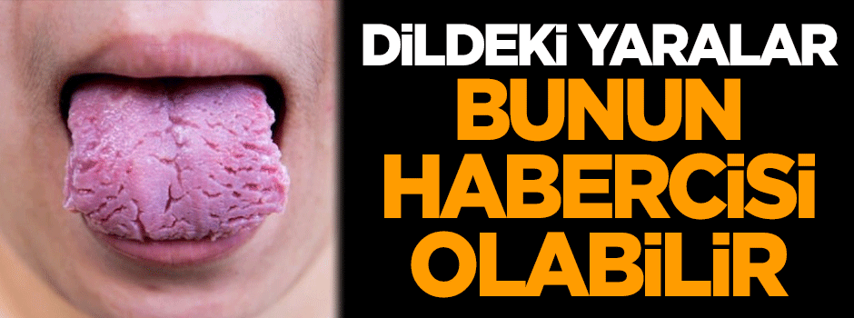 Dildeki yaralar bunun habercisi olabilir