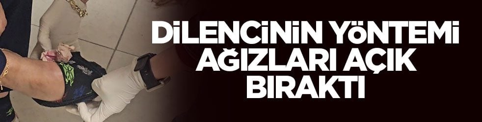 Dilencinin paraları sakladığı yer şoka soktu