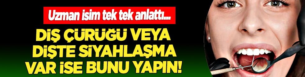 Diş çürüğü veya dişte siyahlaşma fark edilirse... Restoratif diş tedavisi dişleri koruyarak iyileştiriyor
