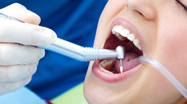 Diş dolgusu orucu bozar mı?