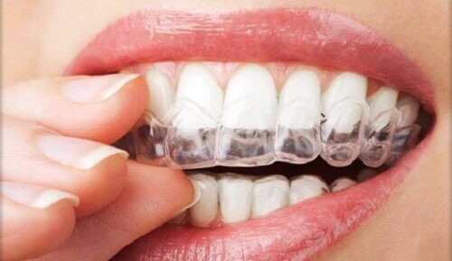 Diş gıcırdatma nasıl engellenir?