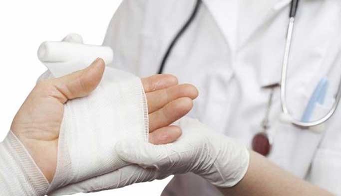 Doğal yollarla yanık nasıl tedavi edilir?