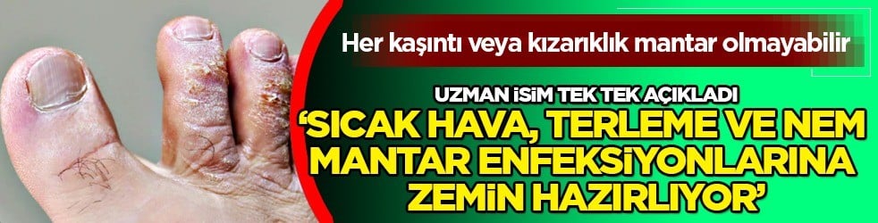 Doktor tavsiye ediyor: Çorap, ayakkabı gibi kişisel eşyaların içleri enfeksiyon dolu... Mantar aktif olurmuş
