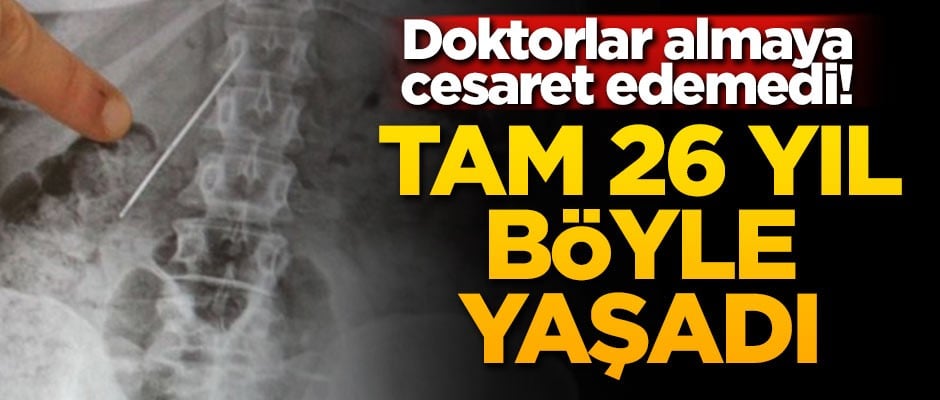 Doktorlar almaya cesaret edemedi! Tam 26 yıl böyle yaşadı