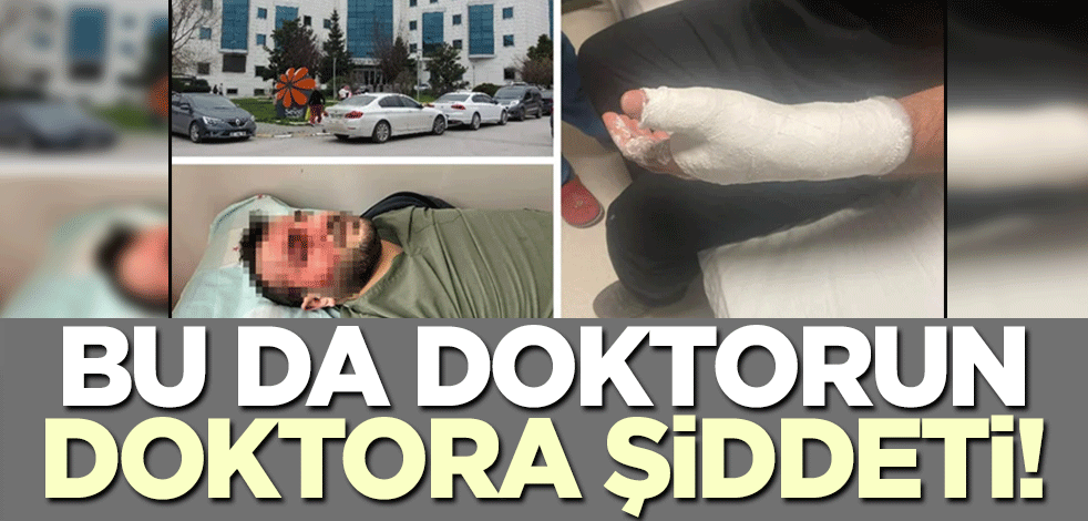 Doktorlar ameliyattan sonra birbirine girdi! 2 yaralı