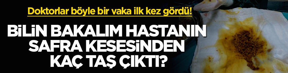 Doktorlar böyle bir vaka ilk kez gördü! Bilin bakalım hastanın safra kesesinden kaç taş çıktı?