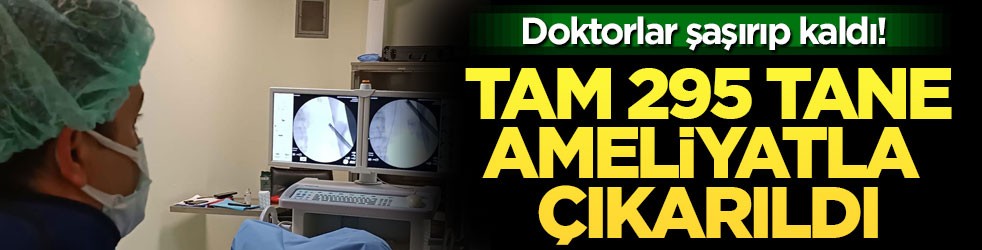 Doktorlar şaşırıp kaldı! Tam 295 tane ameliyatla çıkarıldı