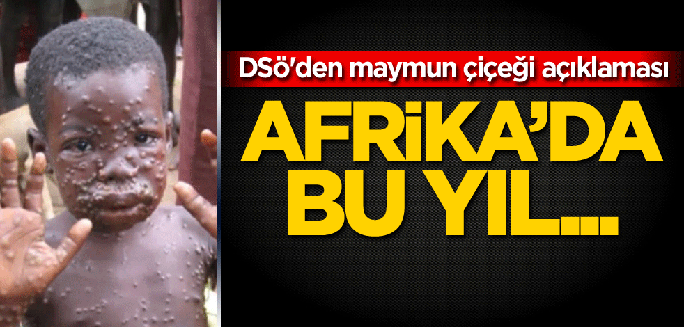 DSÖ'den maymun çiçeği açıklaması! Afrika'da bu yıl...