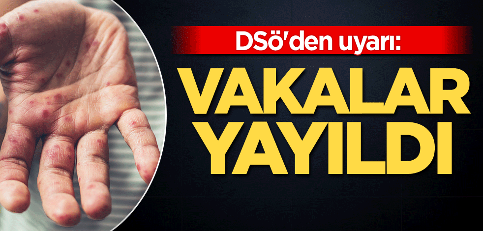DSÖ'den uyarı: Vakalar yayıldı