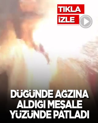 Düğünde ağzına aldığı meşale yüzünde patladı