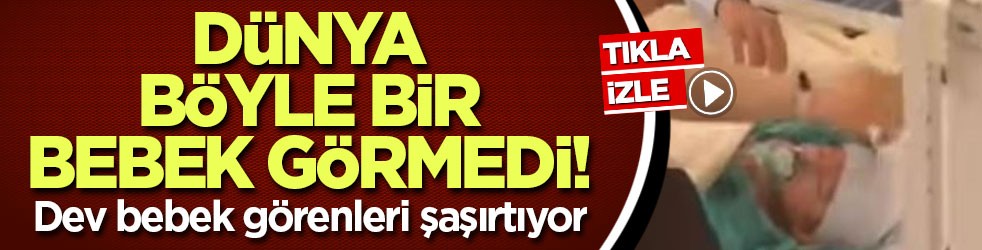 Dünya böyle bir bebek görmedi! Dev bebek görenleri şaşırtıyor