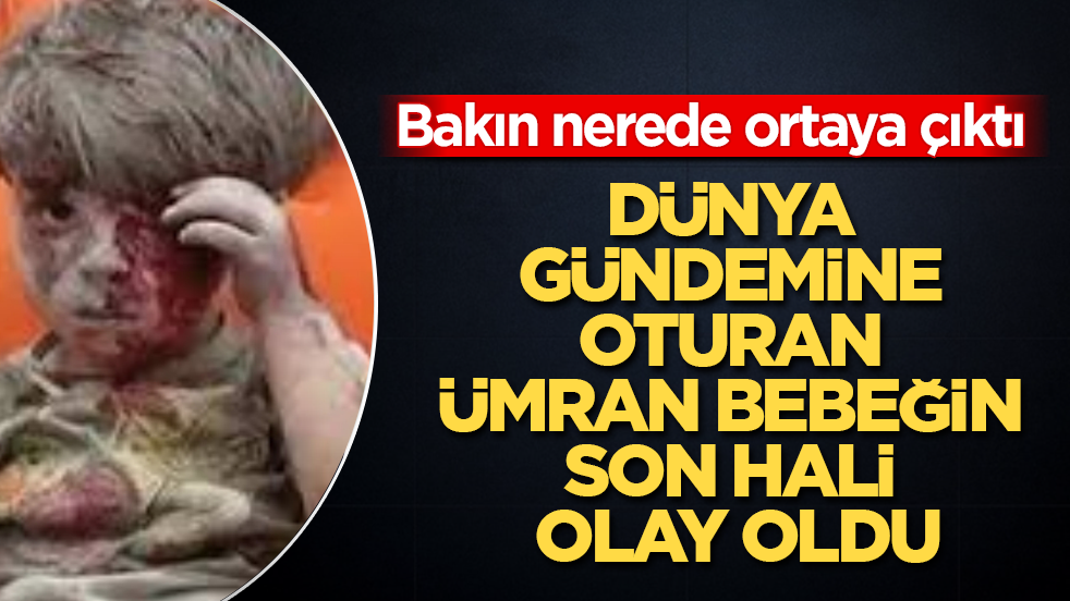 Dünya gündemine oturan Ümran bebeğin son hali olay oldu! Bakın nerede ortaya çıktı