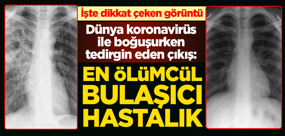 Dünya koronavirüsle boğuşurken tedirgin eden çıkış: En ölümcül bulaşıcı hastalık