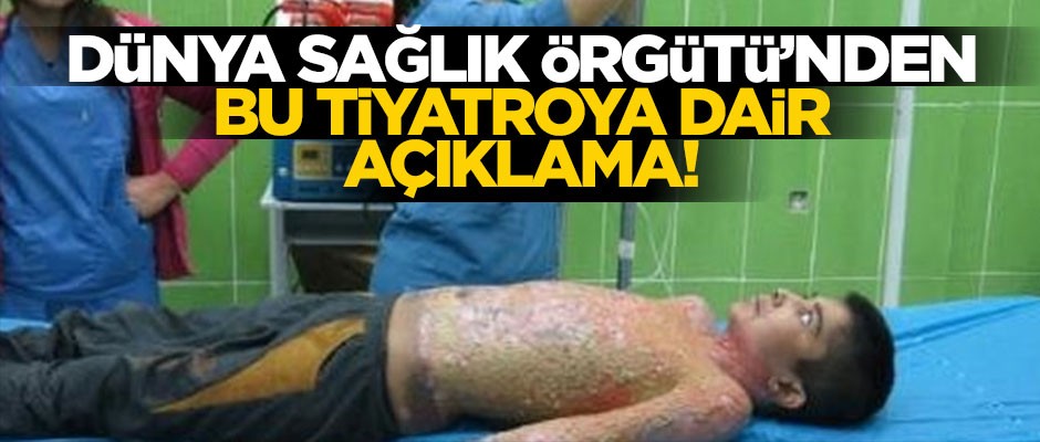 Dünya Sağlık Örgütü'nden kimyasal silah açıklaması!