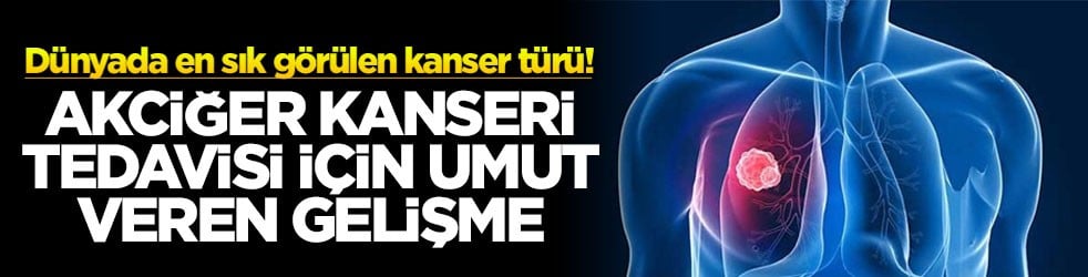 Dünyada en sık görülen kanser türü! Akciğer kanseri tedavisi için umut veren gelişme