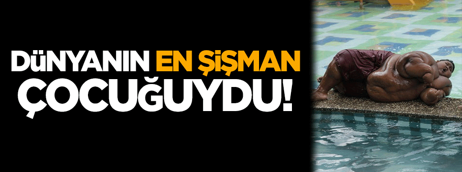 Dünyanın en şişman çocuğuydu! Ameliyat oldu