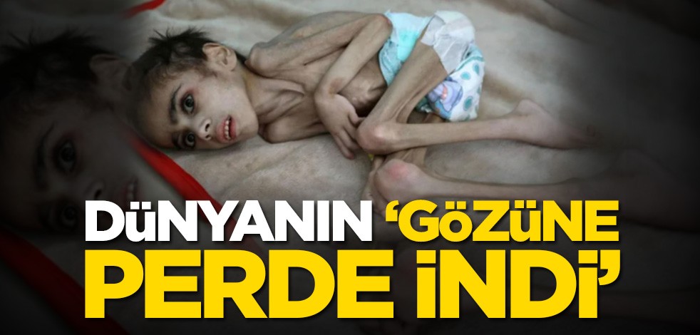 Dünyanın ‘gözüne perde indi’