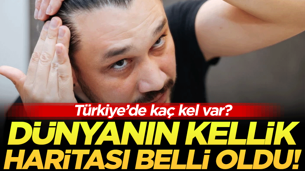 Dünyanın kellik haritasi belli oldu! Türkiye'de kaç tane kel var!