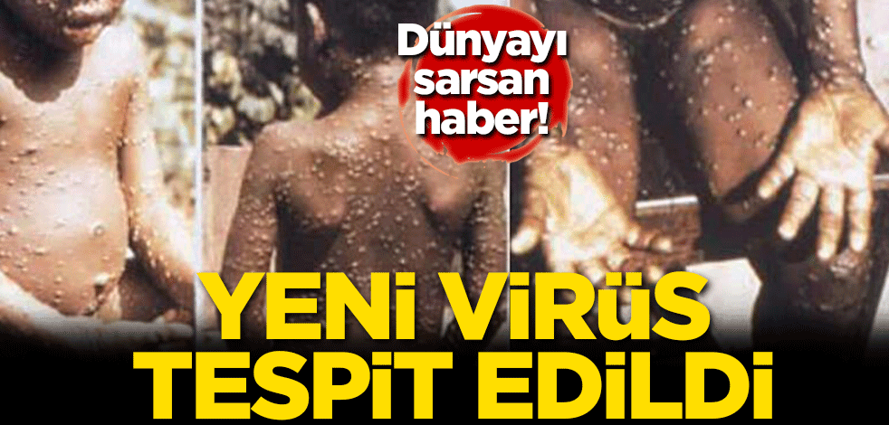 Dünyayı sarsan haber! Yeni virüs tespit edildi
