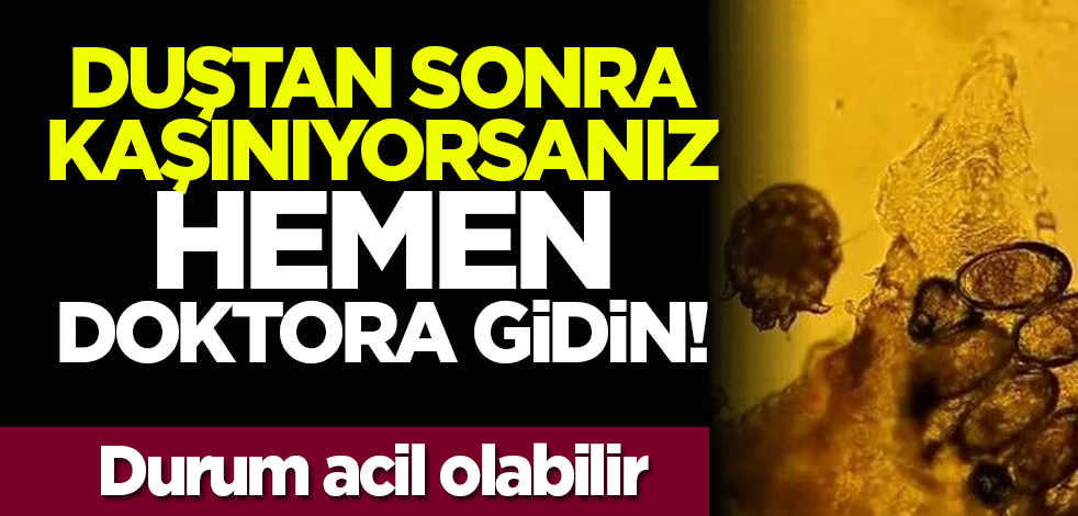 Duştan sonra kaşınıyorsanız hemen doktora gidin! Durum acil olabilir