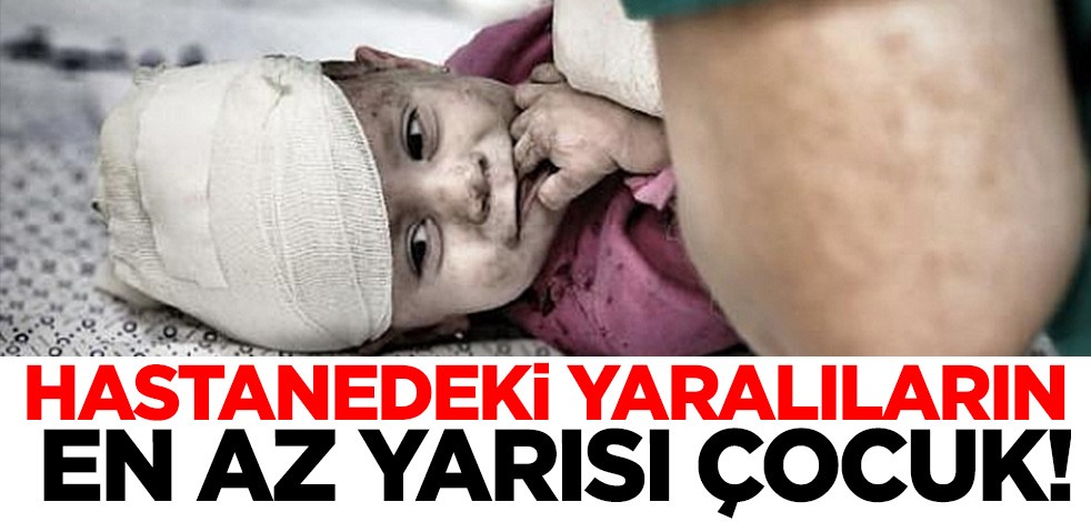 El Aksa Şehitleri Hastanesi'ndeki yaralıların yarısı çocuk!