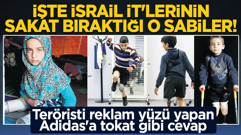 Eli kanlı teröristi reklam yüzü yapan Adidas'a tokat gibi cevap! İşte İsrail İt’lerinin sakat bıraktığı o sabiler