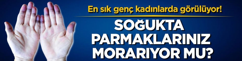 En sık genç kadınlarda görülüyor! Soğukta parmaklarınız morarıyor mu?
