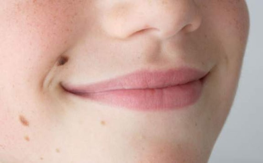 Et beni nasıl düşer?